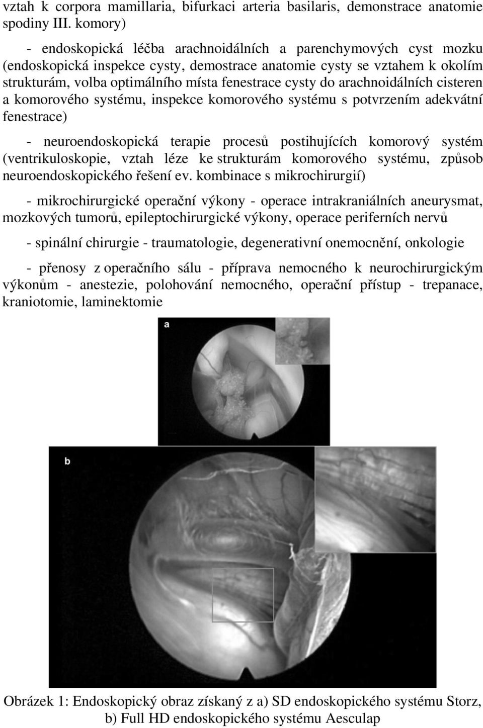 cysty do arachnoidálních cisteren a komorového systému, inspekce komorového systému s potvrzením adekvátní fenestrace) - neuroendoskopická terapie procesů postihujících komorový systém