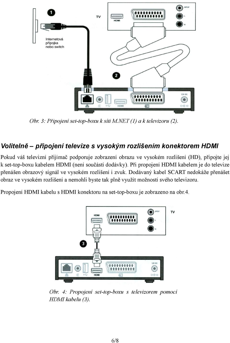 set-top-boxu kabelem HDMI (není součástí dodávky). Při propojení HDMI kabelem je do televize přenášen obrazový signál ve vysokém rozlišení i zvuk.