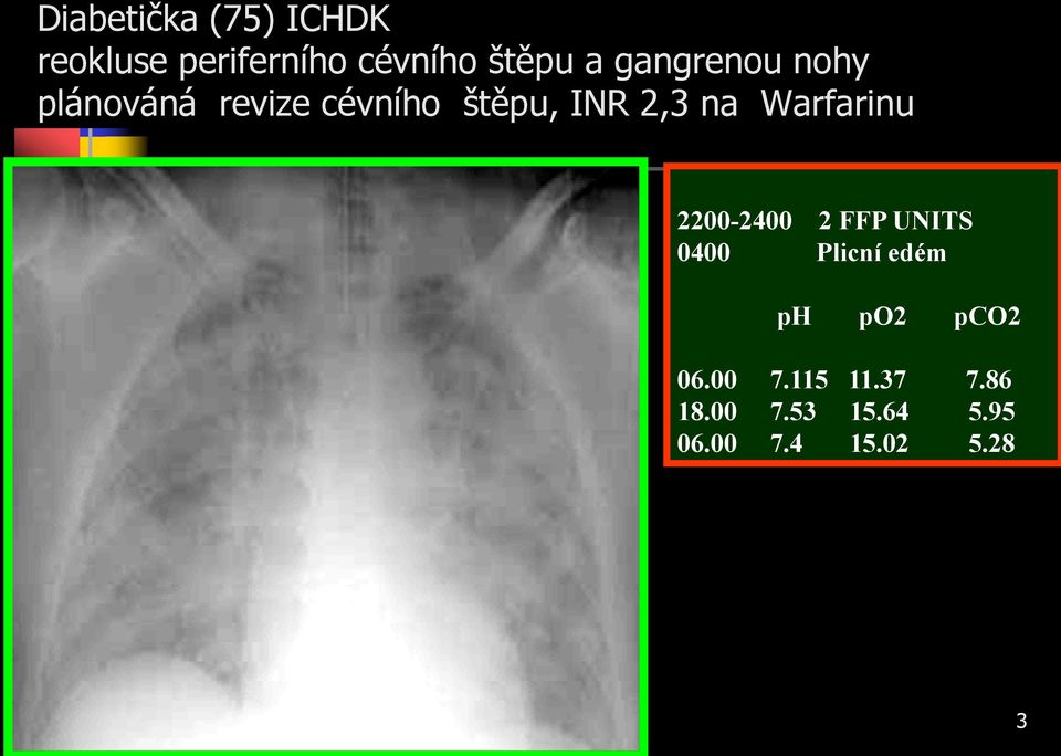 Warfarinu 2200-2400 2 FFP UNITS 0400 Plicní edém ph po2 pco2 06.