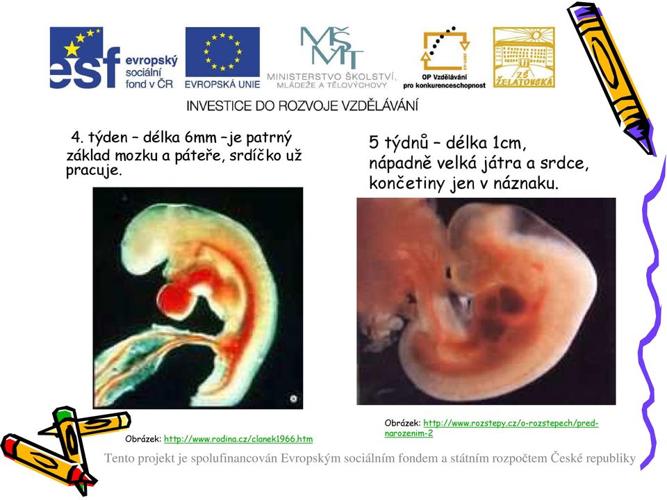 5 týdnů délka 1cm, nápadně velká játra a srdce, končetiny jen