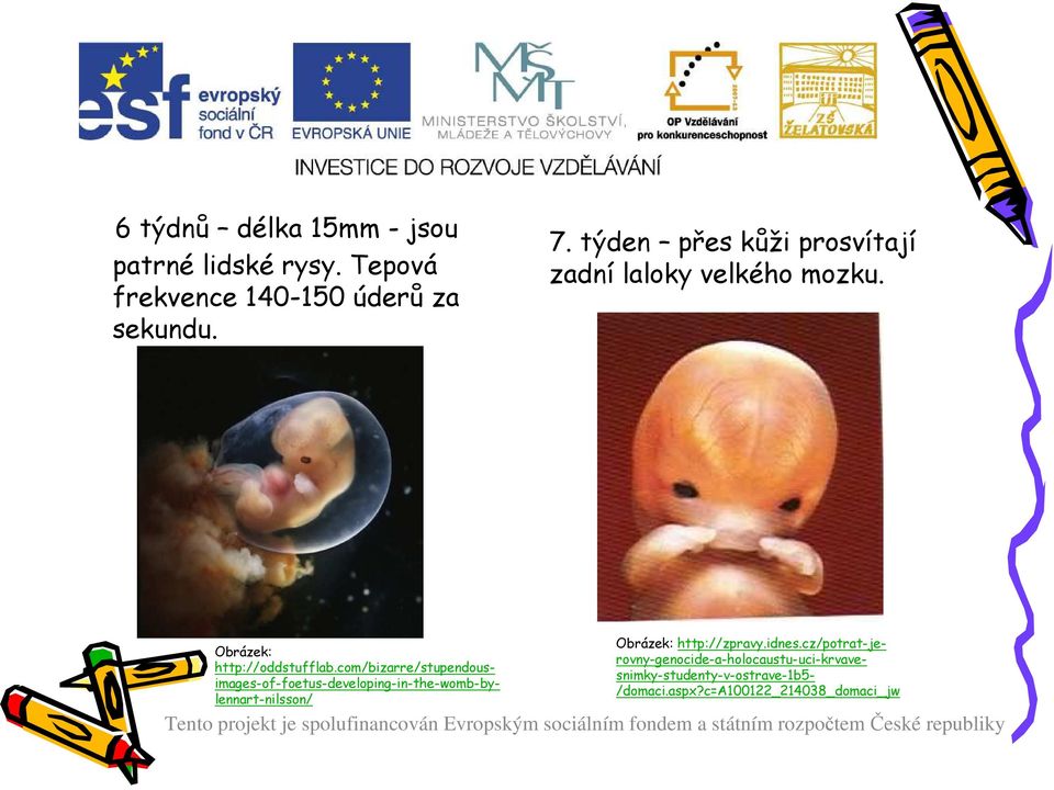 com/bizarre/stupendousimages-of-foetus-developing-in-the-womb-bylennart-nilsson/ Obrázek: