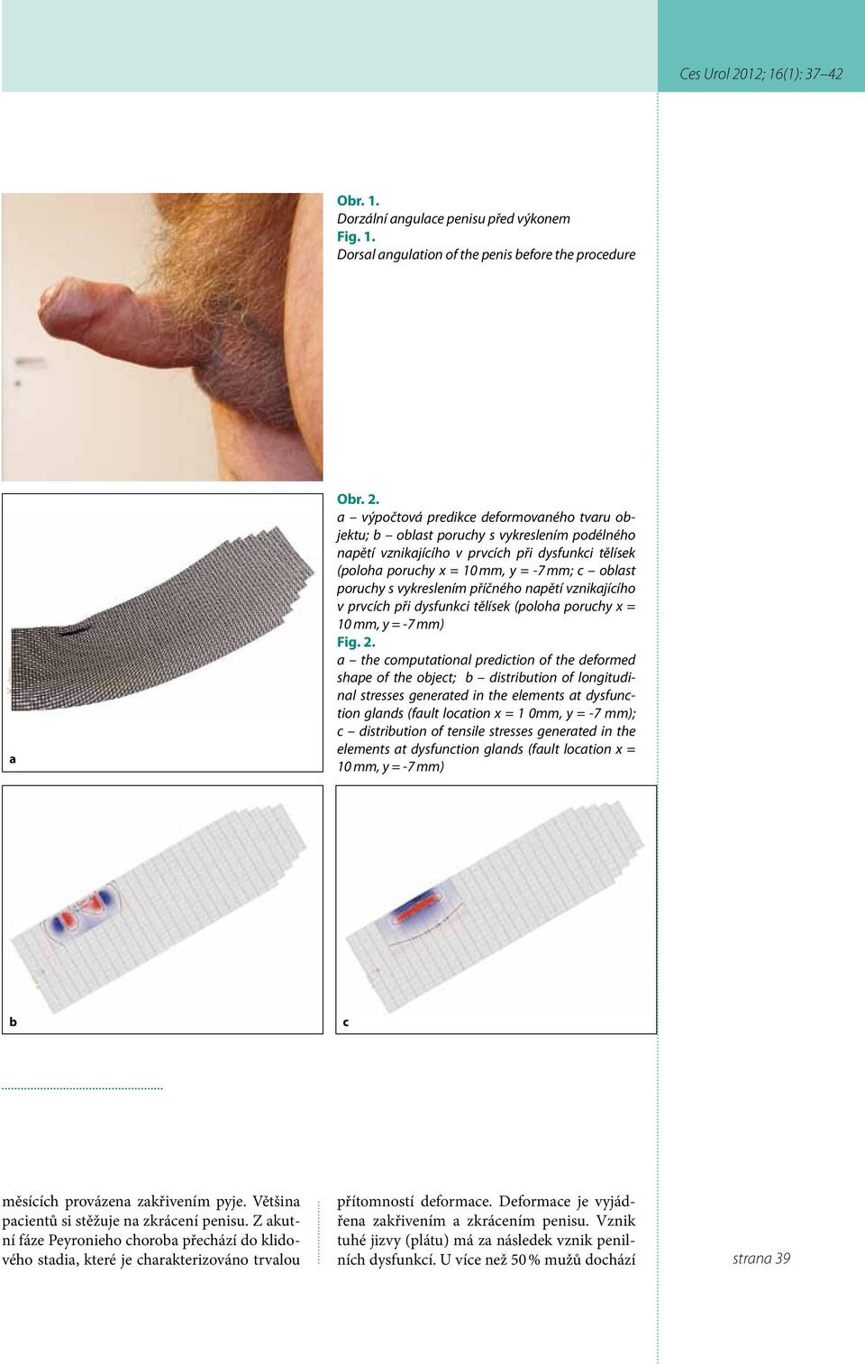 vykreslením příčného napětí vznikajícího v prvcích při dysfunkci tělísek (poloha poruchy x = 10 mm, y = -7 mm) Fig. 2.