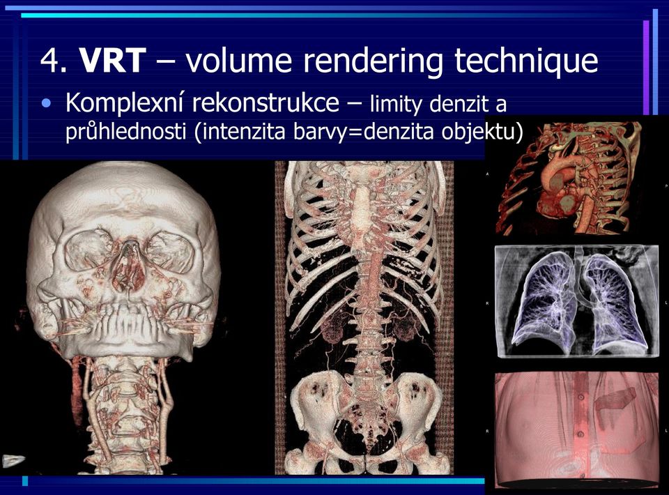 rekonstrukce limity denzit a