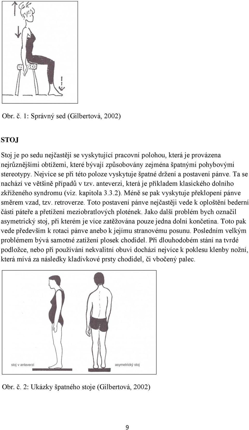 stereotypy. Nejvíce se při této poloze vyskytuje špatné držení a postavení pánve. Ta se nachází ve většině případů v tzv. anteverzi, která je příkladem klasického dolního zkříženého syndromu (viz.