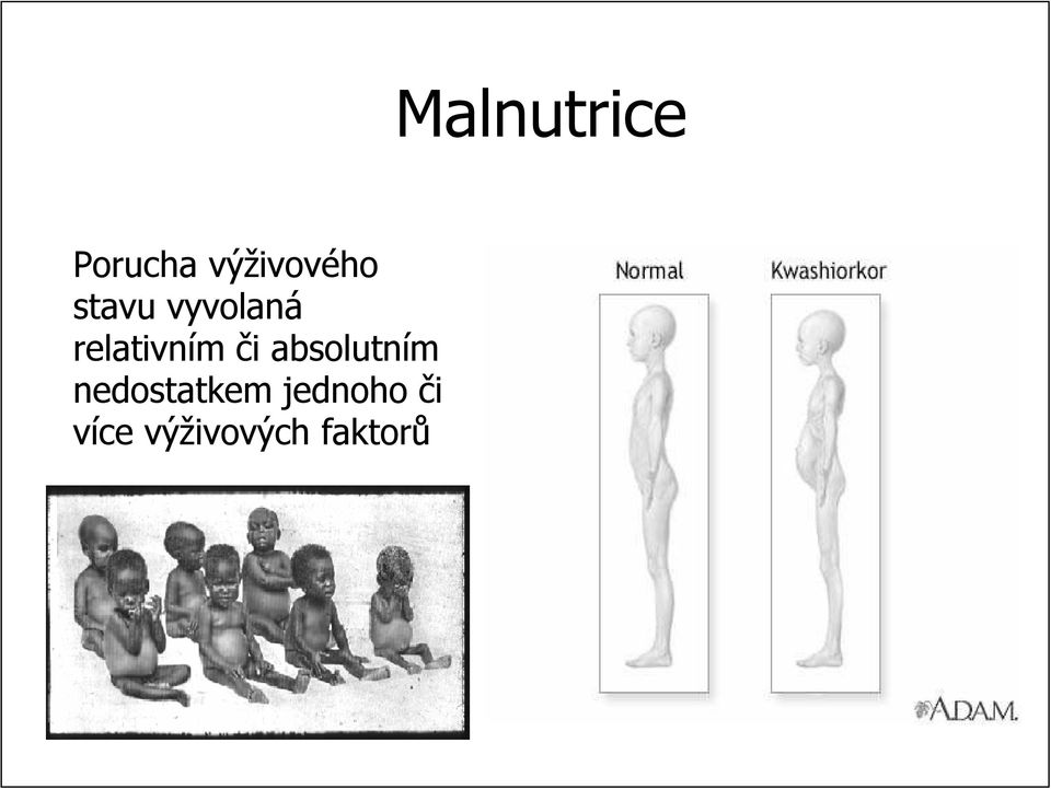 relativním či i absolutním