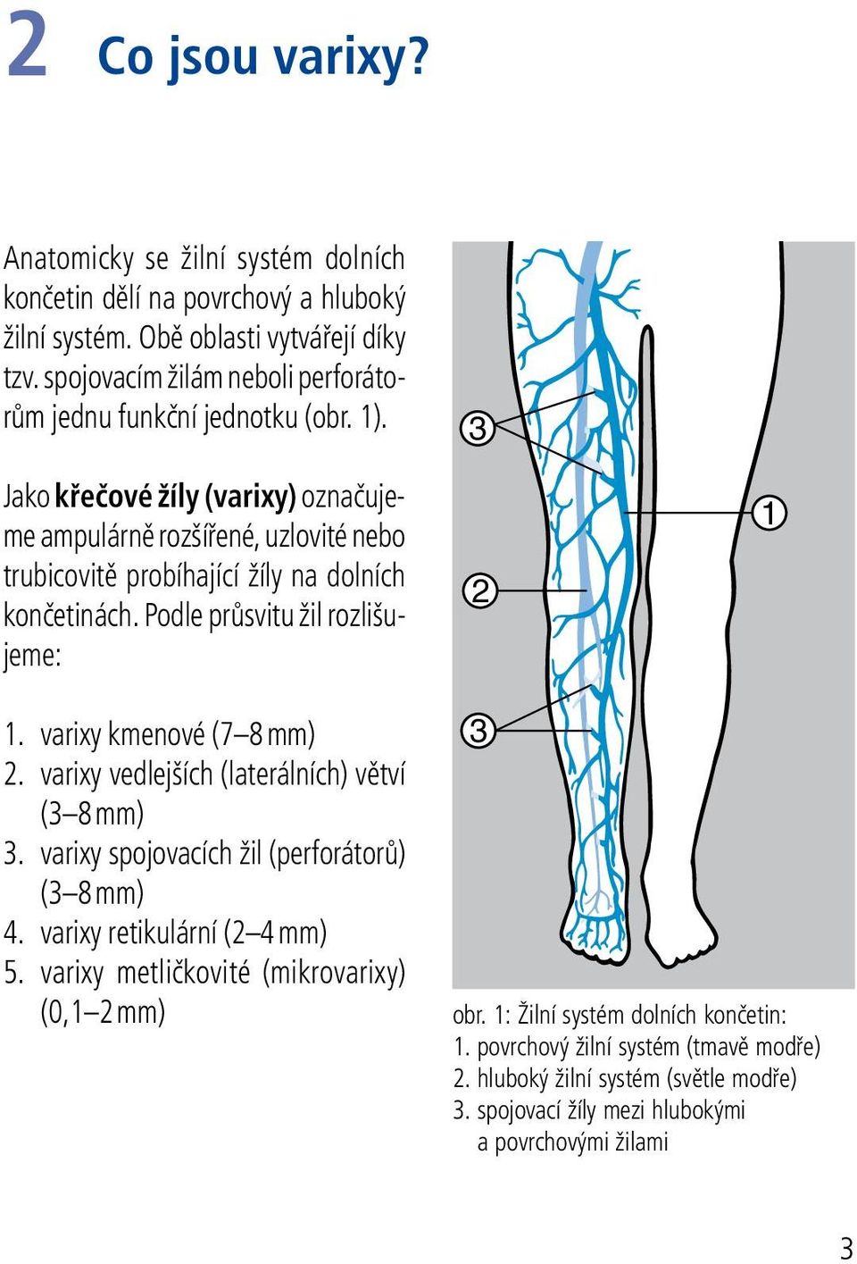 Jako křečové žíly (varixy) označujeme ampulárně rozšířené, uzlovité nebo trubicovitě probíhající žíly na dolních končetinách. Podle průsvitu žil rozlišujeme: 1.