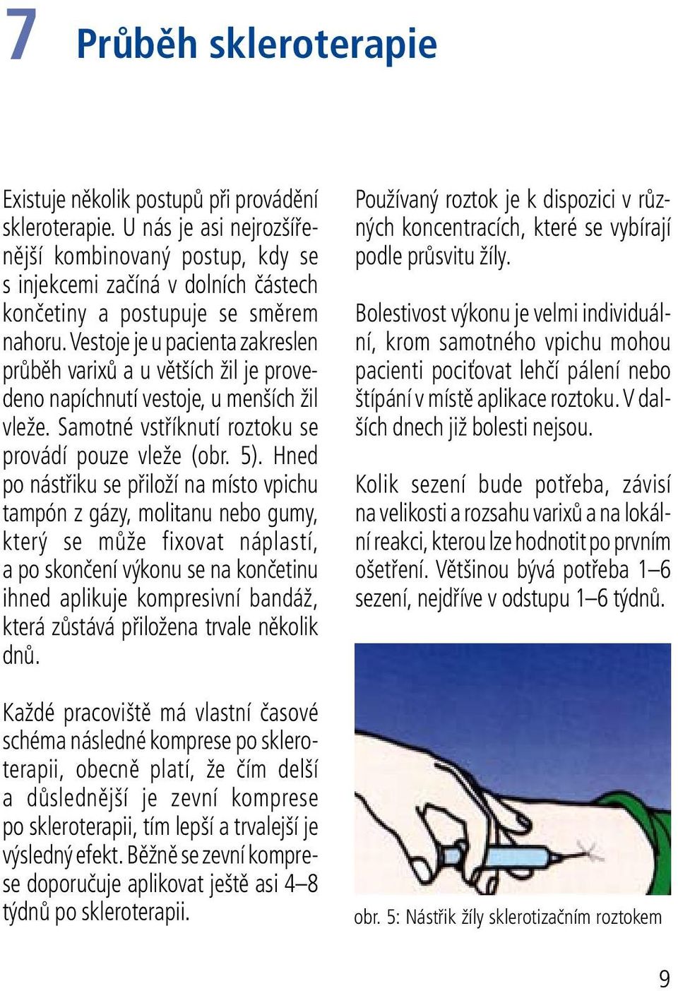 Vestoje je u pacienta zakreslen průběh varixů a u větších žil je provedeno napíchnutí vestoje, u menších žil vleže. Samotné vstříknutí roztoku se provádí pouze vleže (obr. 5).