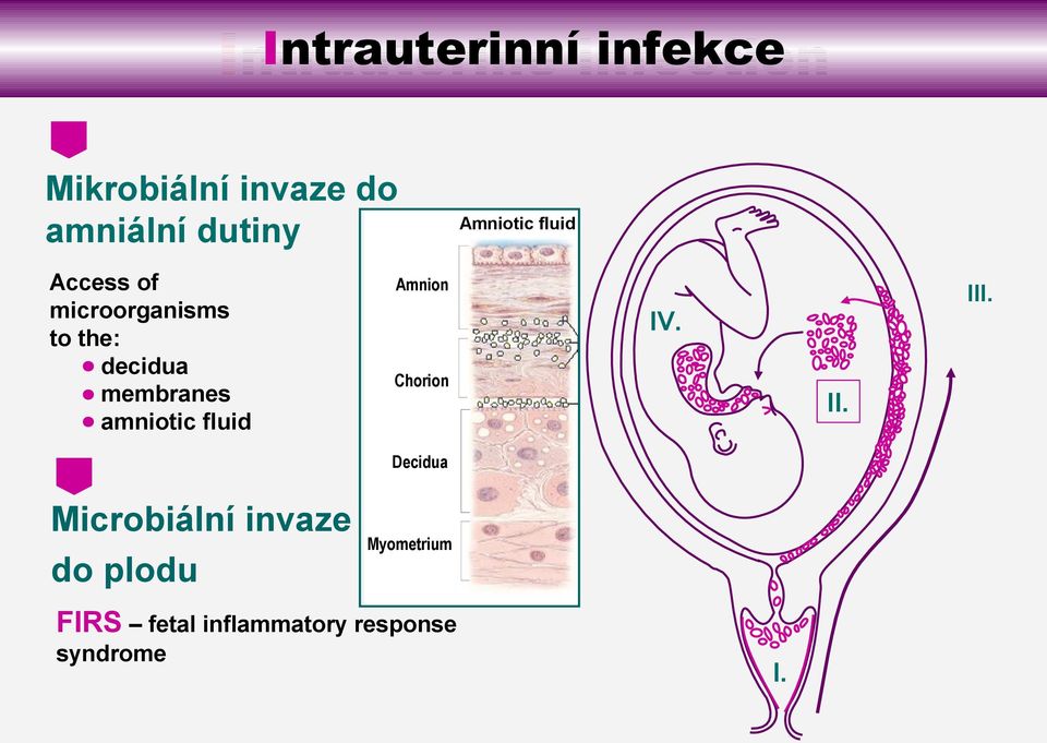 amniotic fluid Amniotic fluid Amnion III. IV. Chorion II.