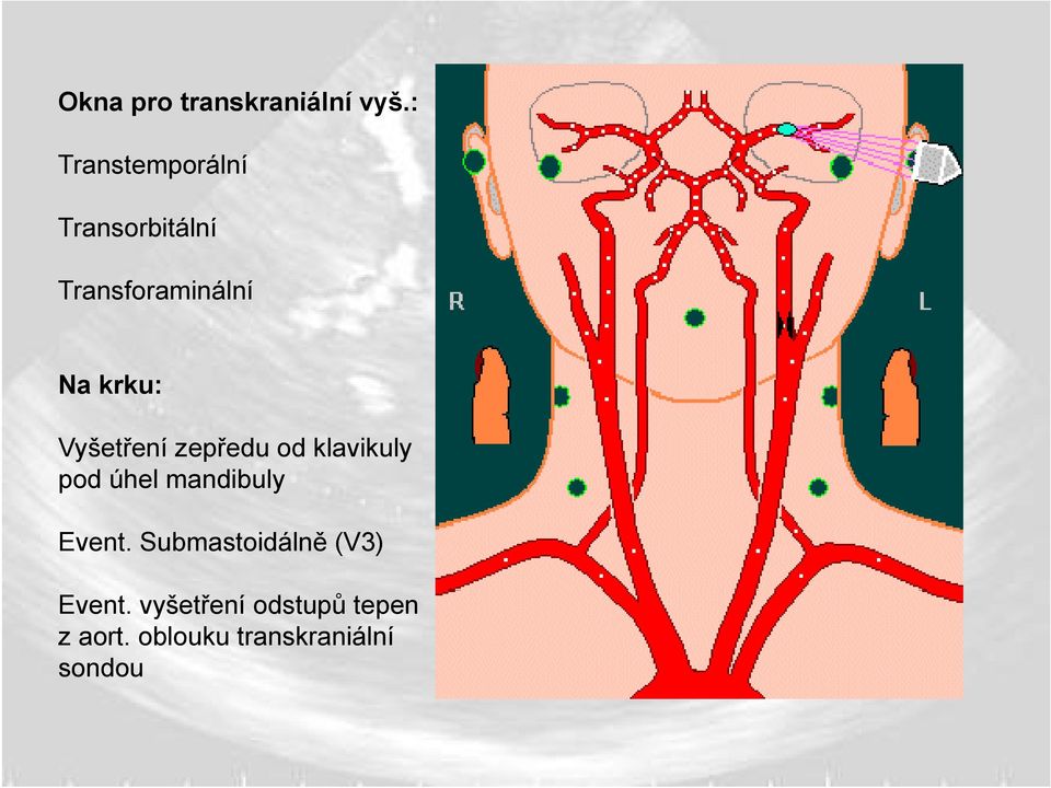 krku: Vyšetření zepředu od klavikuly pod úhel mandibuly