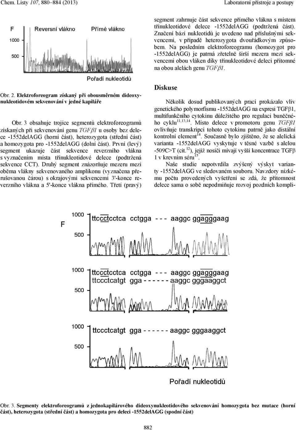 Na posledním elektroforeogramu (homozygot pro -1552delAGG) je patrná zřetelně širší mezera mezi sekvencemi obou vláken díky třínukleotidové deleci přítomné na obou alelách genu TGF 1. Obr. 2.