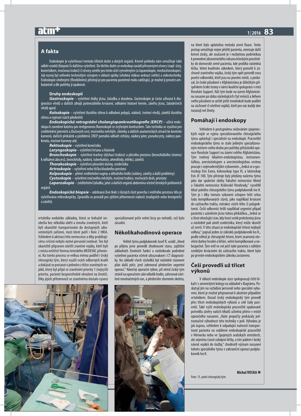 Její rozvoj byl ovlivněn technickým vývojem v oblasti optiky (ohebná vlákna vedoucí světlo) a videotechniky.
