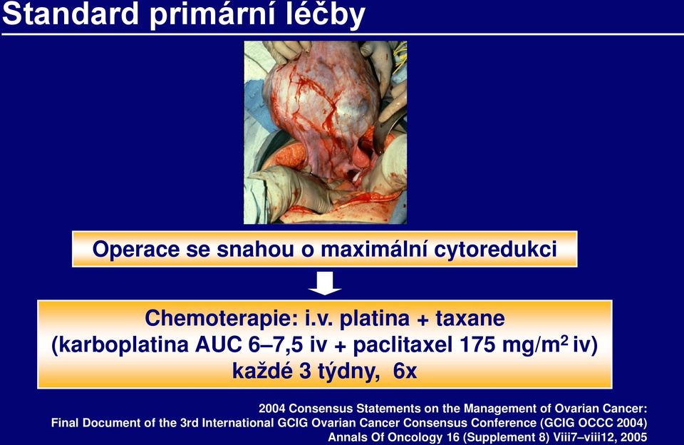 Consensus Statements on the Management of Ovarian Cancer: Final Document of the 3rd International