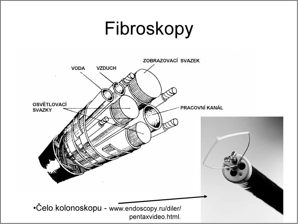 endoscopy.