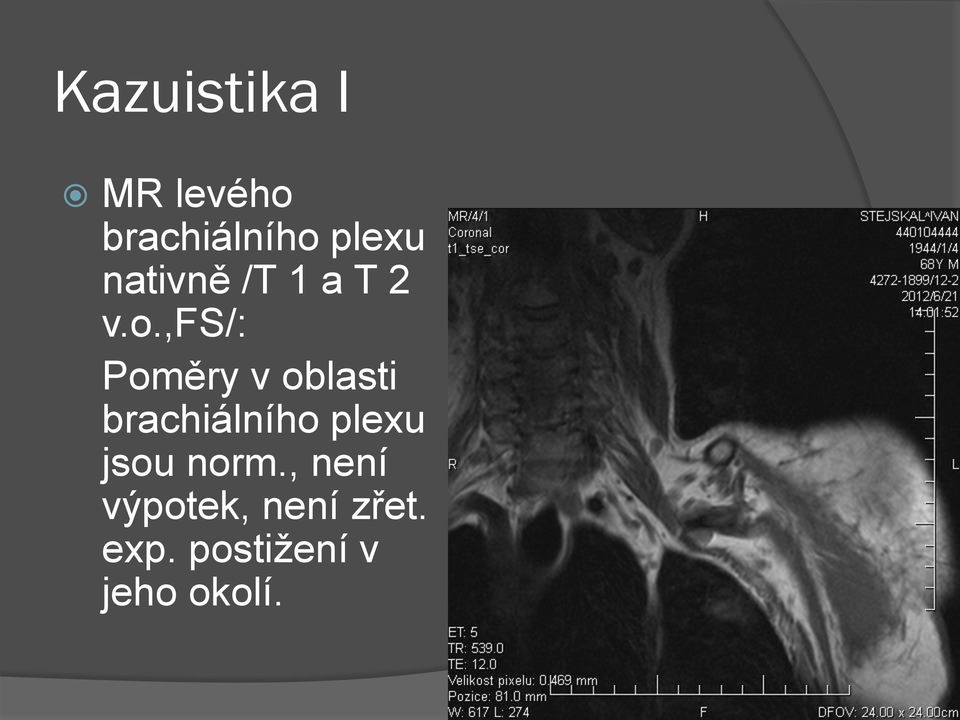 ,fs/: Poměry v oblasti brachiálního plexu