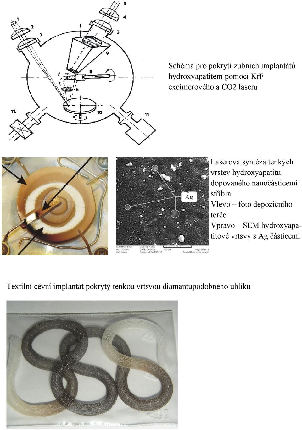 nanočásticemi stříbra Vlevo foto depozičního terče Vpravo SEM hydroxyapatitové