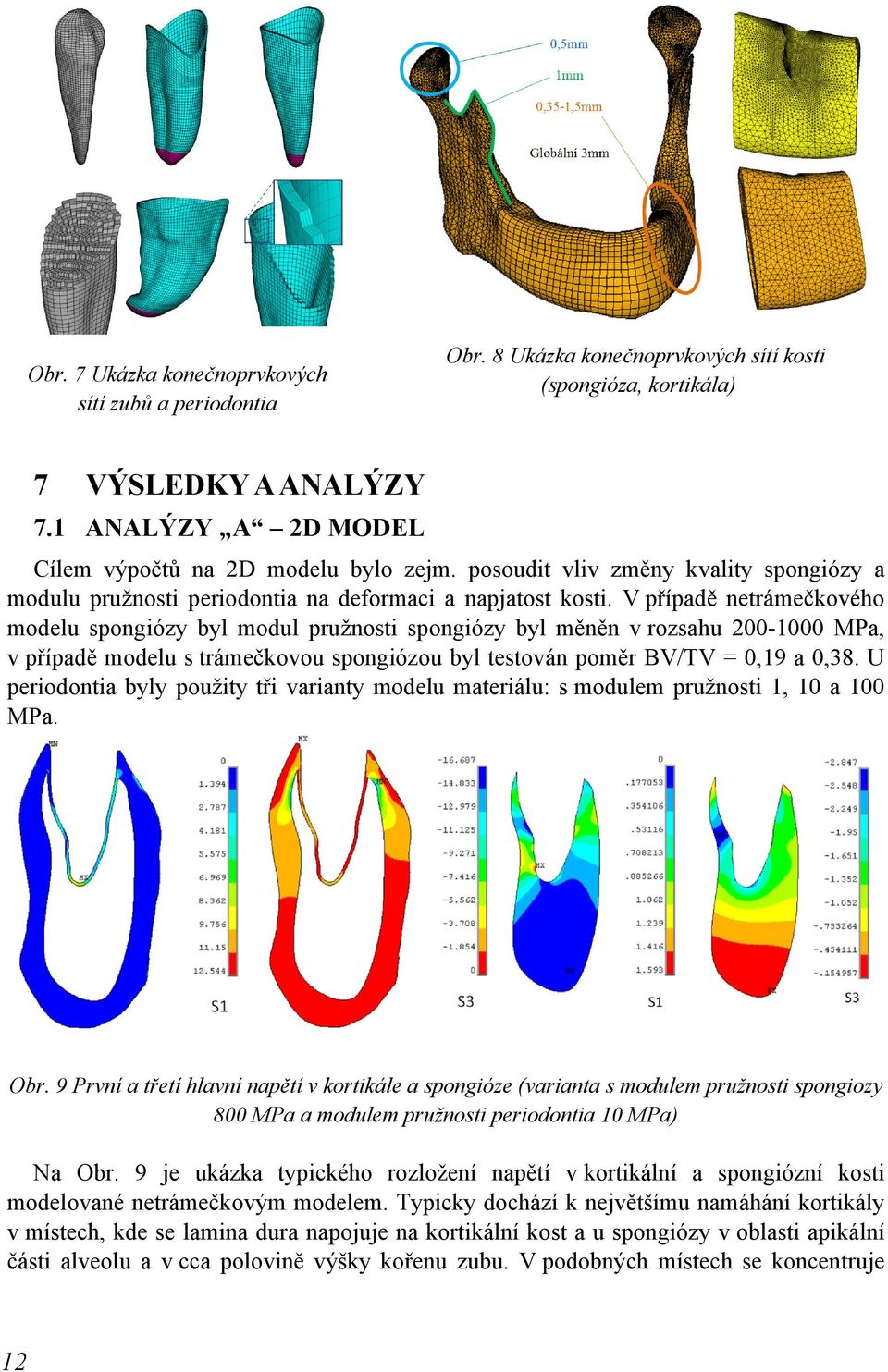 V případě netrámečkového modelu spongiózy byl modul pružnosti spongiózy byl měněn v rozsahu 200-1000 MPa, v případě modelu s trámečkovou spongiózou byl testován poměr BV/TV = 0,19 a 0,38.