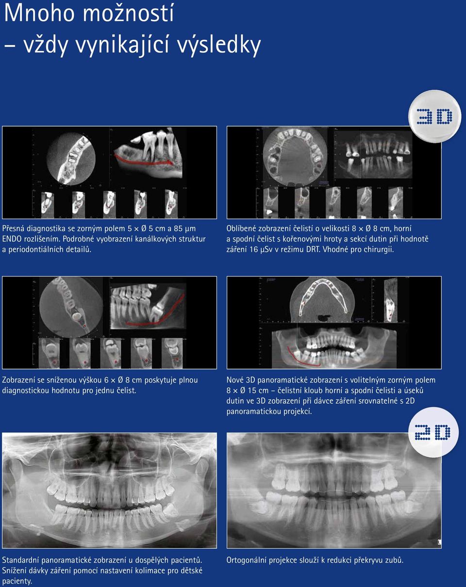 Zobrazení se sníženou výškou 6 Ø 8 cm poskytuje plnou diagnostickou hodnotu pro jednu čelist.