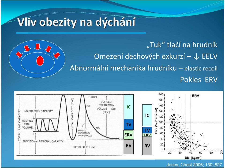 hrudníku elastic recoil Pokles ERV IC
