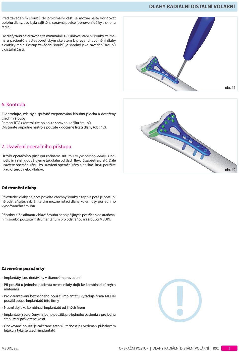 Postup zavádění šroubů je shodný jako zavádění šroubů v distální části. obr. 11 6. Kontrola zkontrolujte, zda byla správně zreponována kloubní plocha a dotaženy všechny šrouby.