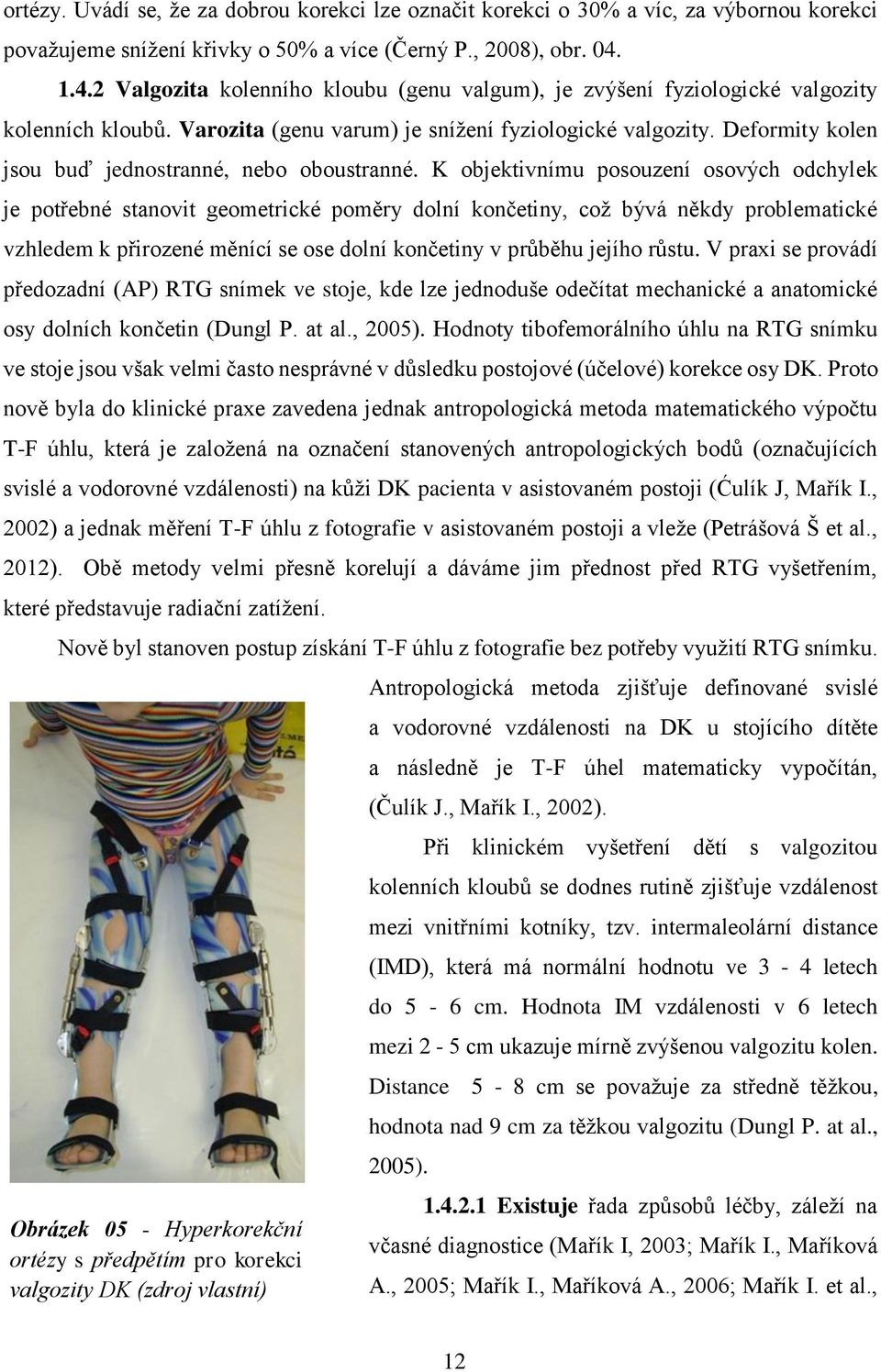 Deformity kolen jsou buď jednostranné, nebo oboustranné.