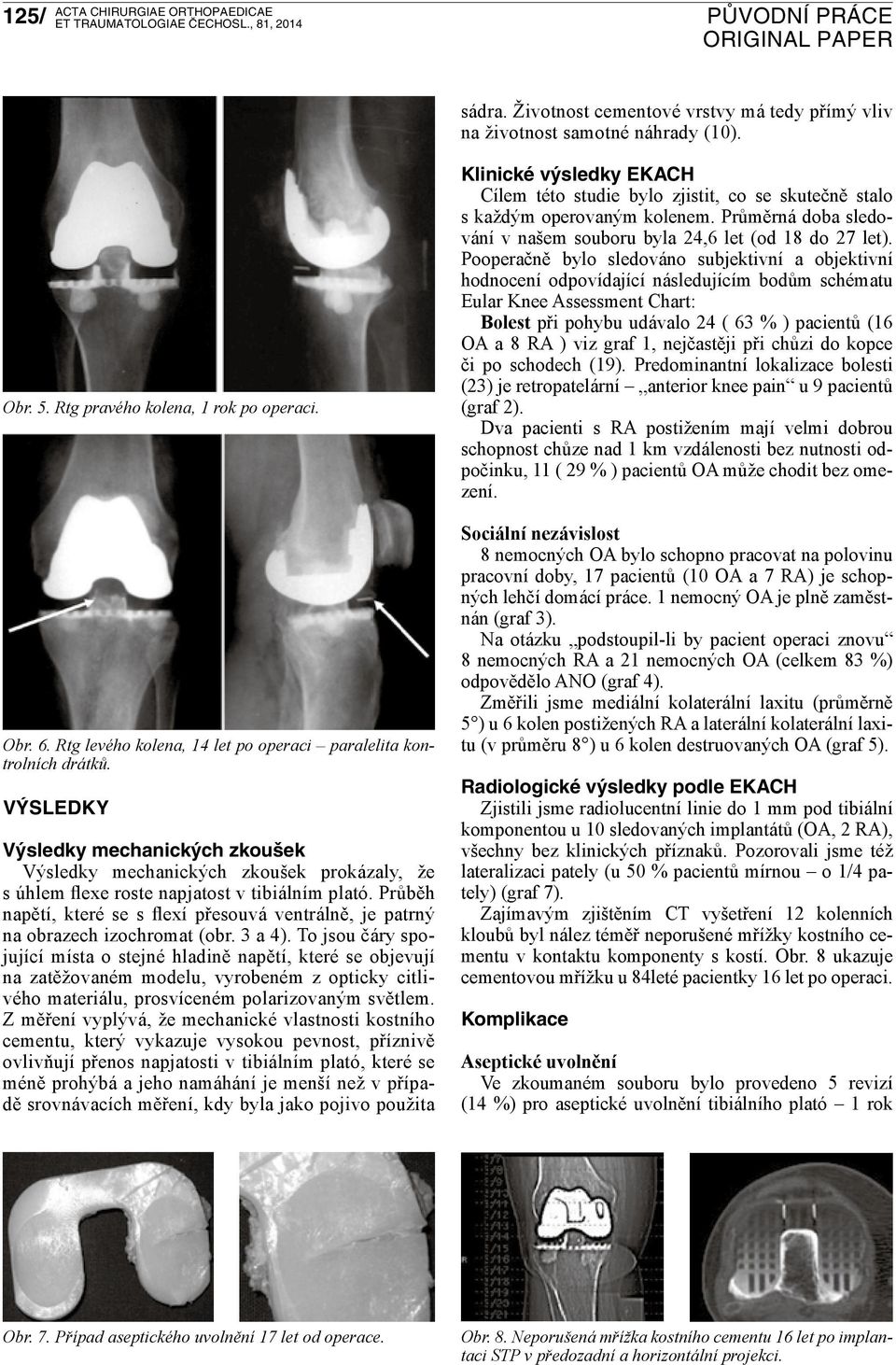 Průběh napětí, které se s flexí přesouvá ventrálně, je patrný na obrazech izochromat (obr. 3 a 4).