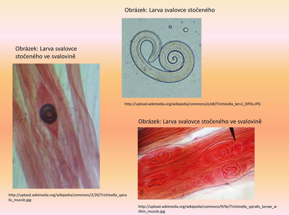 jpg Obrázek: Larva svalovce stočeného ve svalovině http://upload.wikimedia.