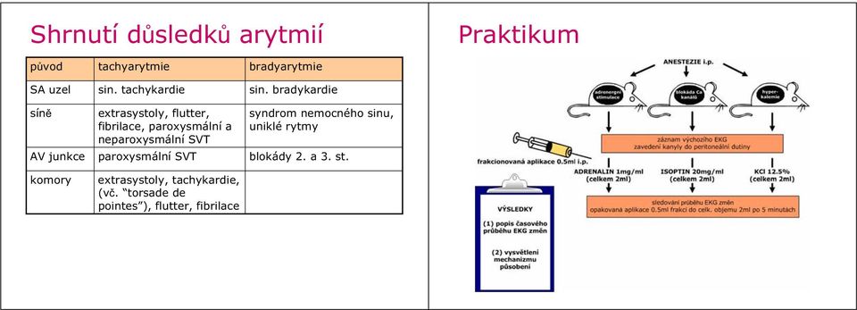 bradykardie sín extrasystoly, flutter, fibrilace, paroxysmální a neparoxysmální SVT