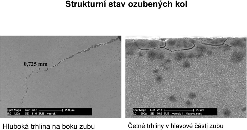 trhlina na boku zubu