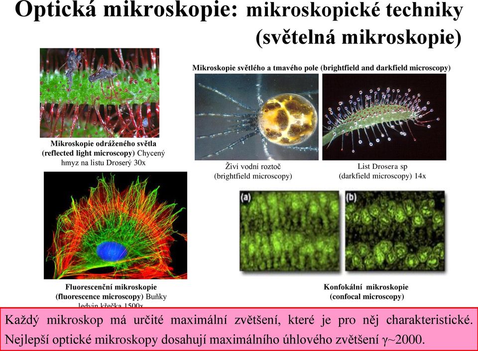 sp (darkfield microscopy) 14x Fluorescenční mikroskopie (fluorescence microscopy) Buňky ledvin křečka 1500x Konfokální mikroskopie (confocal