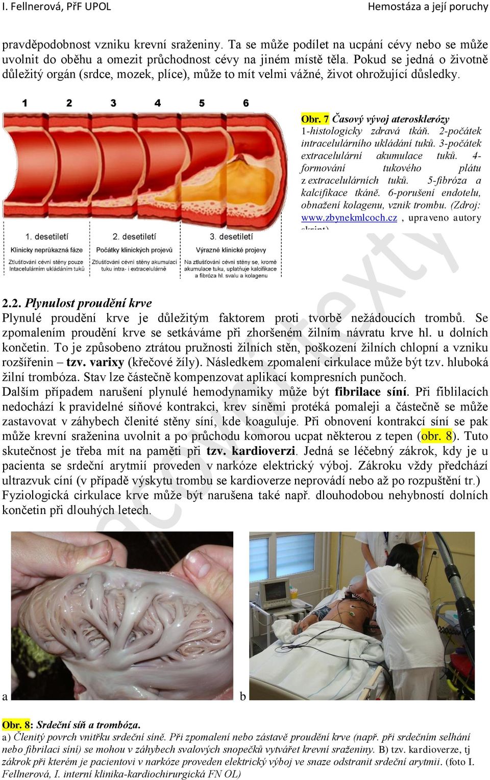 2-počátek intracelulárního ukládání tuků. 3-počátek extracelulární akumulace tuků. 4- formování tukového plátu z extracelulárních tuků. 5-fibróza a kalcifikace tkáně.