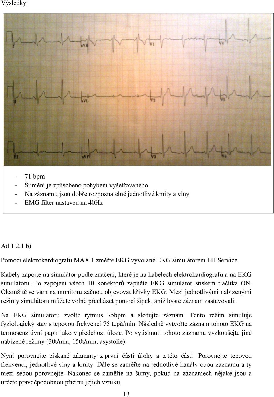 Po zapojení všech 10 konektorů zapněte EKG simulátor stiskem tlačítka ON. Okamţitě se vám na monitoru začnou objevovat křivky EKG.