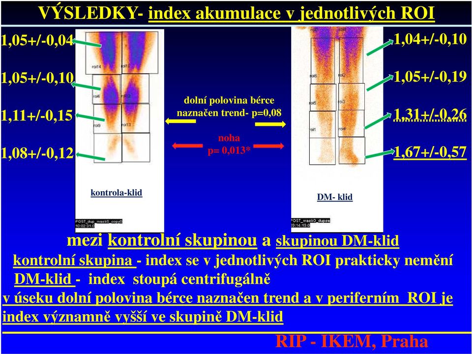 kontrolní skupinou a skupinou DM-klid kontrolní skupina - index se v jednotlivých ROI prakticky nemění DM-klid - index