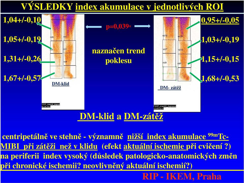 stehně - významně nižší index akumulace 99m Tc- MIBI při zátěži než v klidu (efekt aktuální ischemie při cvičení?