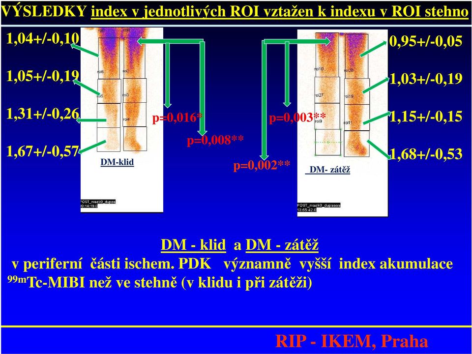 p=0,008** p=0,002** DM- zátěž 1,68+/-0,53 DM - klid a DM - zátěž v periferní části