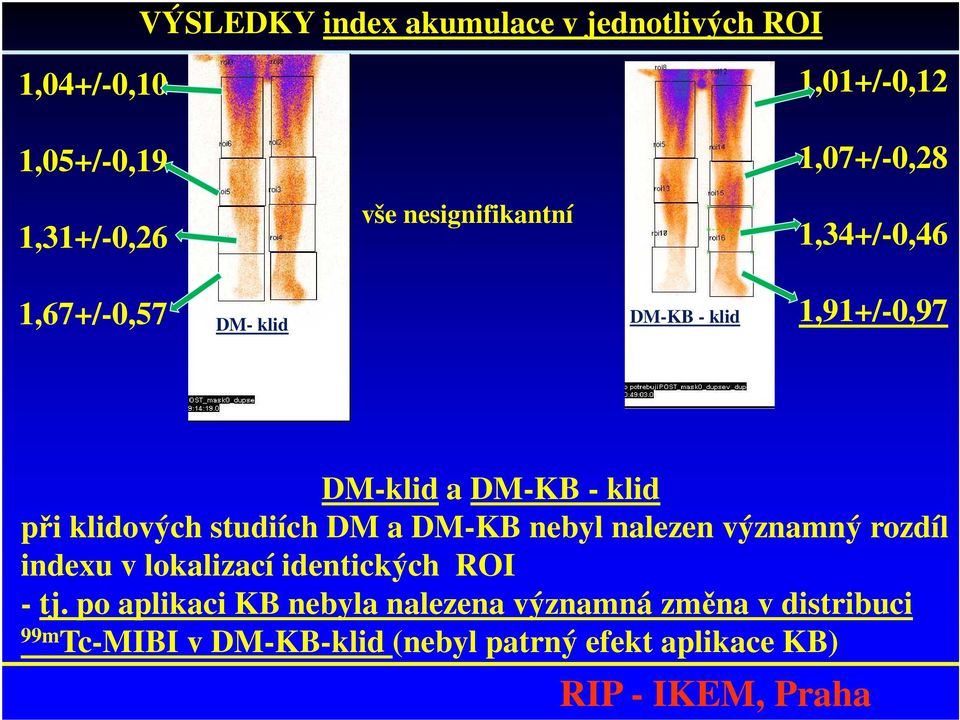 při klidových studiích DM a DM-KB nebyl nalezen významný rozdíl indexu v lokalizací identických ROI - tj.