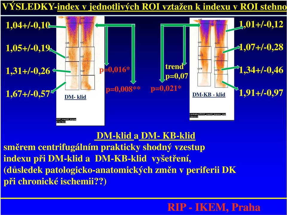 - klid 1,91+/-0,97 DM-klid a DM- KB-klid směrem centrifugálním prakticky shodný vzestup indexu při