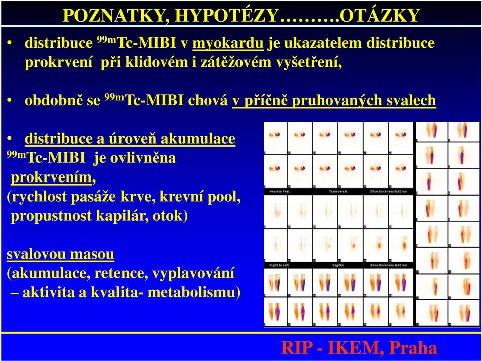 zátěžovém vyšetření, obdobně se 99m Tc-MIBI chová v příčně pruhovaných svalech distribuce a úroveň