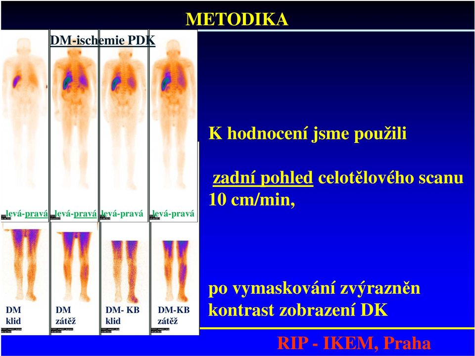 pohled celotělového scanu 10 cm/min, DM DM DM- KB DM-KB