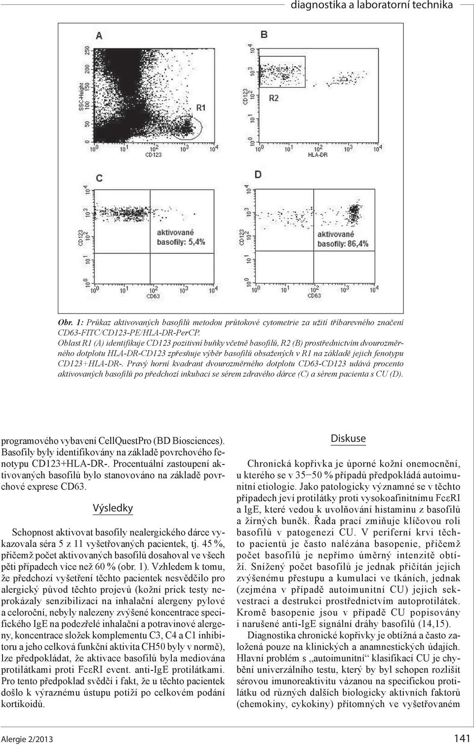 CD123+HLA-DR-. Pravý horní kvadrant dvourozměrného dotplotu CD63-CD123 udává procento aktivovaných basofilů po předchozí inkubaci se sérem zdravého dárce (C) a sérem pacienta s CU (D).