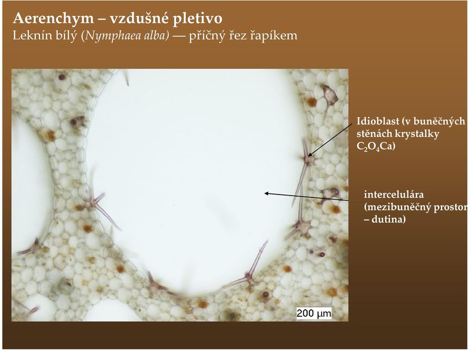 Idioblast (v buněčných stěnách krystalky