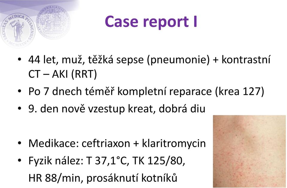 látásélesség herpeszes keratitisz esetén hogyan lehet javítani a látást a 2-ben