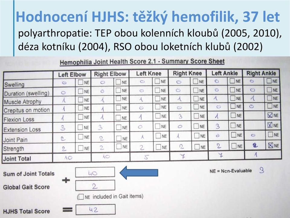 kolenních kloubů (2005, 2010), déza