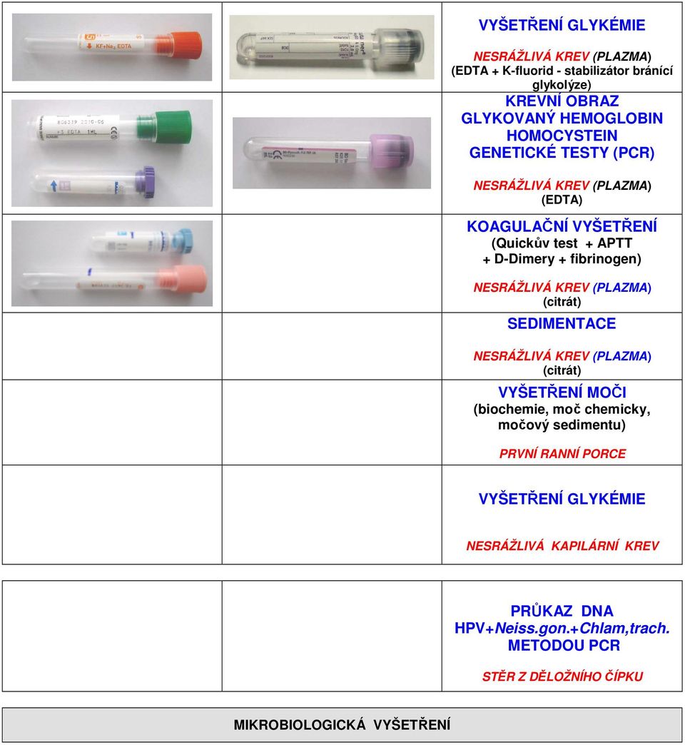 NESRÁŽLIVÁ KREV (PLAZMA) (citrát) SEDIMENTACE NESRÁŽLIVÁ KREV (PLAZMA) (citrát) VYŠETŘENÍ MOČI (biochemie, moč chemicky, močový sedimentu)