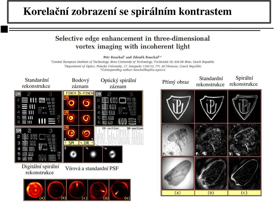 Přímý obraz Standardní rekonstrukce Spirální