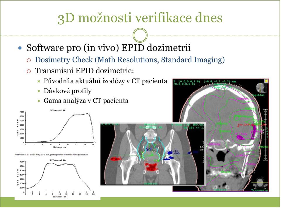 Imaging) Transmisní EPID dozimetrie: Původní a aktuální