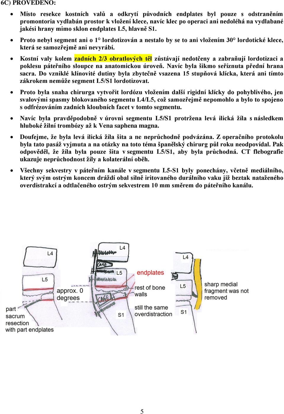 Kostní valy kolem zadních 2/3 obratlových těl zůstávají nedotčeny a zabraňují lordotizaci a poklesu páteřního sloupce na anatomickou úroveň. Navíc byla šikmo seříznuta přední hrana sacra.