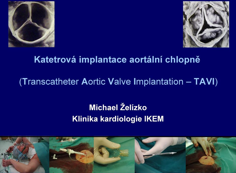 Valve Implantation TAVI)