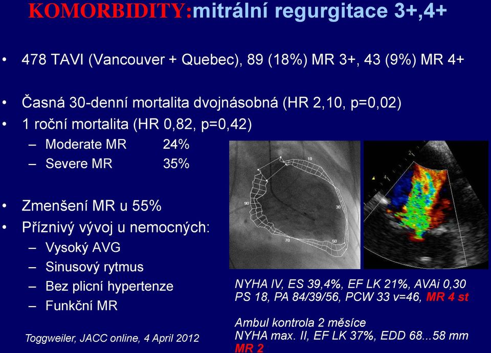 u nemocných: Vysoký AVG Sinusový rytmus Bez plicní hypertenze Funkční MR Toggweiler, JACC online, 4 April 2012 NYHA IV, ES