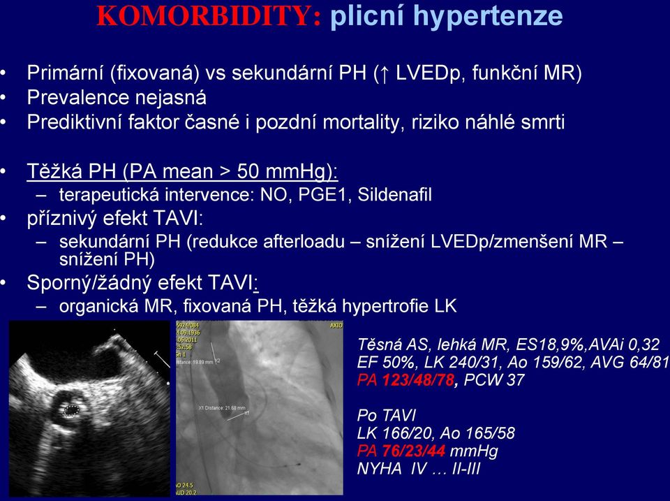 (redukce afterloadu snížení LVEDp/zmenšení MR snížení PH) Sporný/žádný efekt TAVI: organická MR, fixovaná PH, těžká hypertrofie LK Těsná AS,