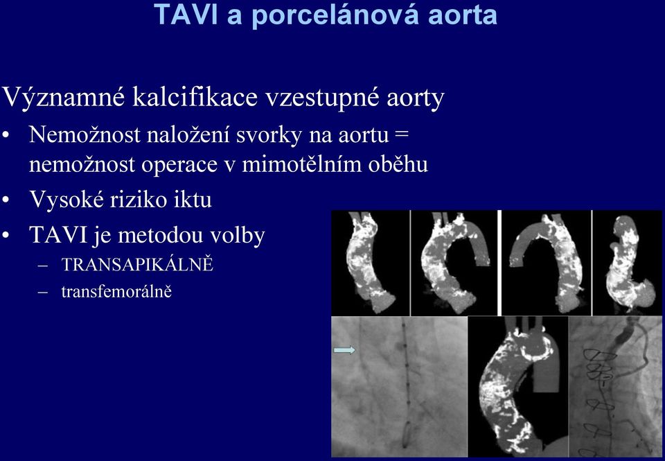 = nemožnost operace v mimotělním oběhu Vysoké